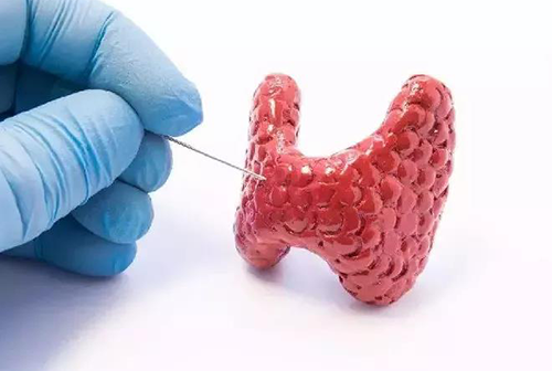 甲状腺疾病，包括甲状腺功能减退和甲状腺功能亢进，自古以来就是反复被医学研究人员研究的疾病